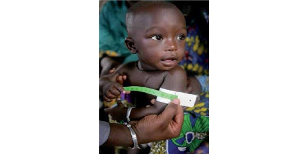 Imagen en miniatura de entrada